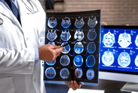 5 tipos de lesiones cerebrales por accidente de tráfico en Louisiana