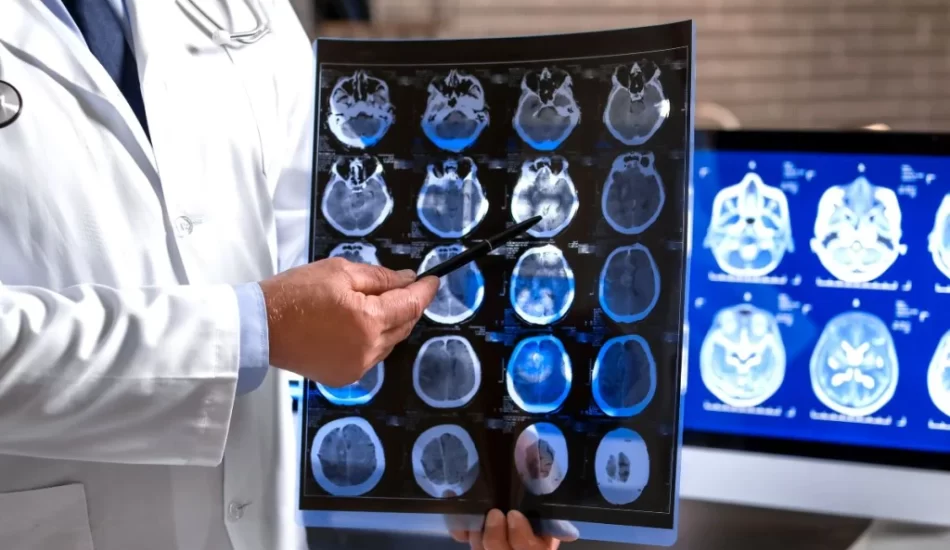5 tipos de lesiones cerebrales por accidente de tráfico en Louisiana